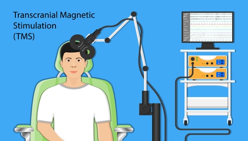 Pacific Psychiatric Centers - Blog - Interventional Psychiatric Treatments - TMS - Transcranial Magnetic Stimulation